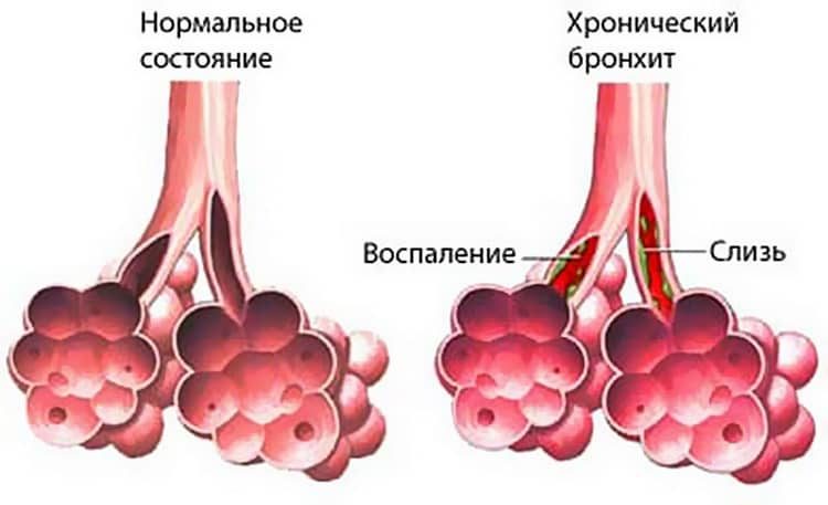 Береза троутовская: лечебные свойства.